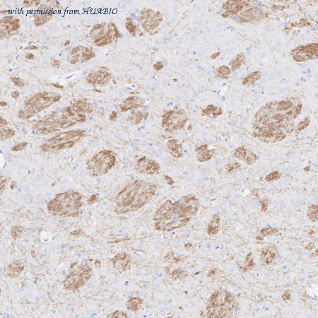 HUABIO HA601505 image 3