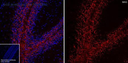 HUABIO HA601510 image 1