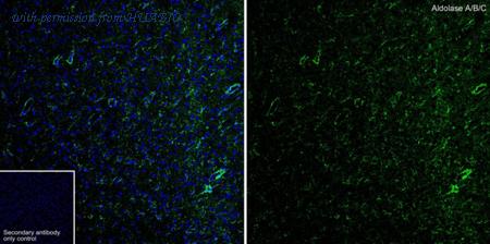 HUABIO HA601511 image 1