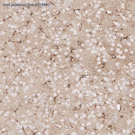 HUABIO HA601511 image 2