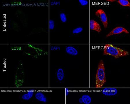 HUABIO HA601532 image 2