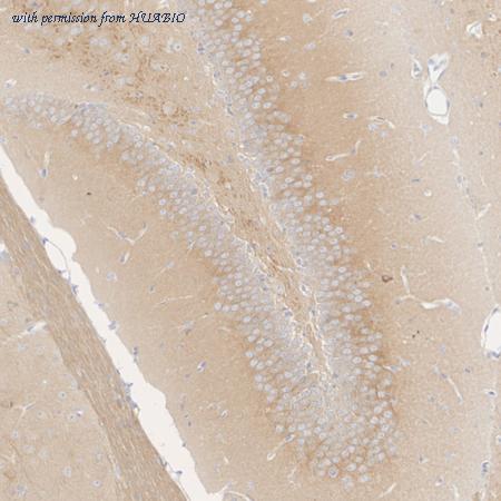 HUABIO HA601532 image 3