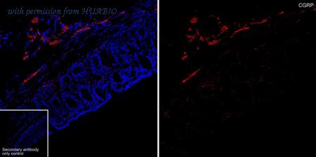 HUABIO HA601540 image 1