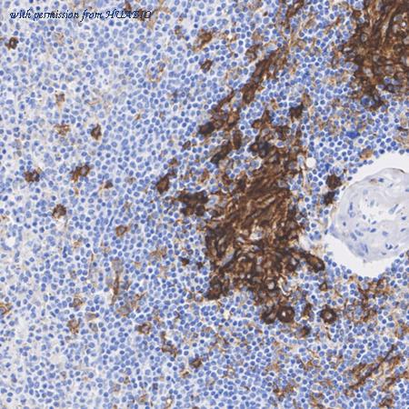 HUABIO HA601545 image 2