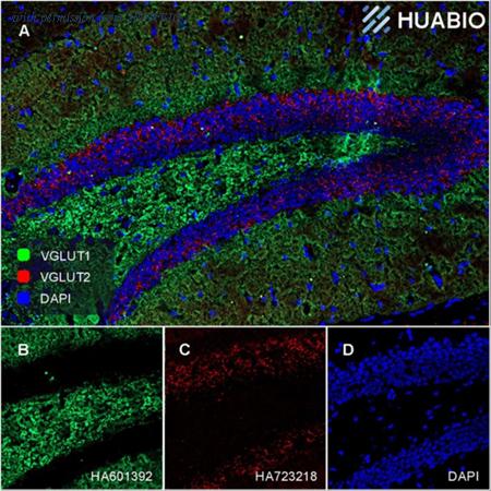 HUABIO HA610234 image 1