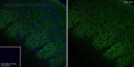 HUABIO HA610235 image 2