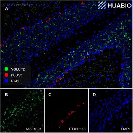 HUABIO HA610235 image 3