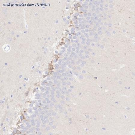 HUABIO HA610238 image 3