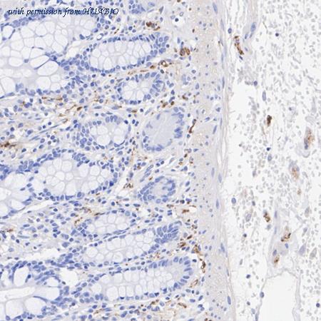 HUABIO HA610241 image 2