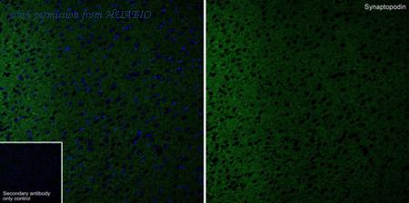 HUABIO HA610242 image 1