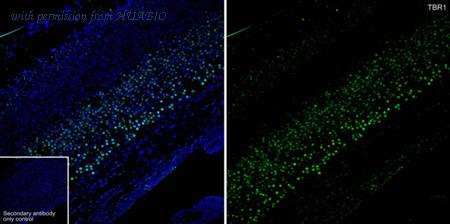 HUABIO HA610262 image 1