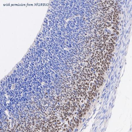 HUABIO HA610262 image 2