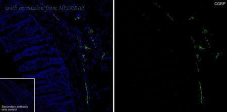 HUABIO HA610263 image 1