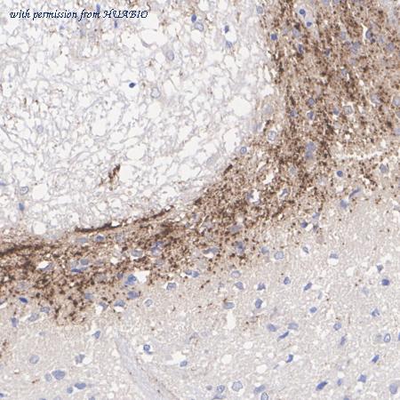 HUABIO HA610263 image 3