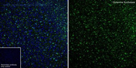 HUABIO HA610268 image 1