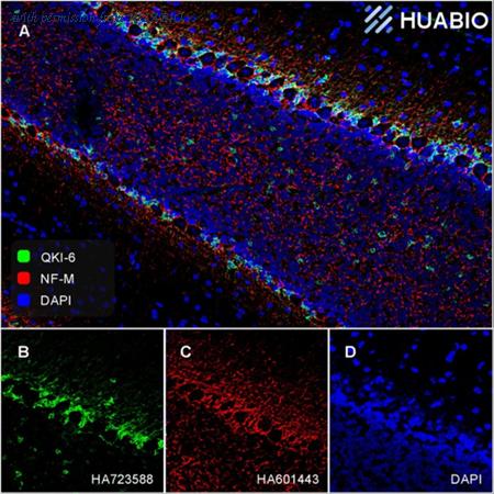 HUABIO HA610278 image 1