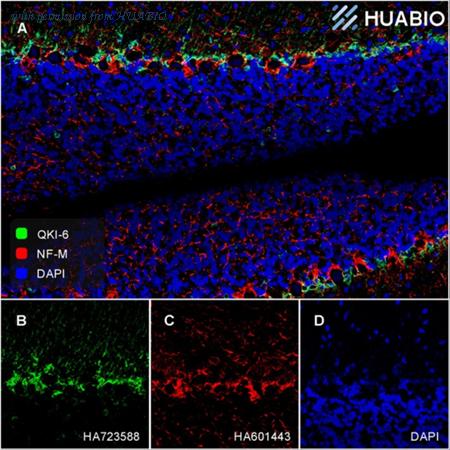HUABIO HA610278 image 2