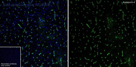 HUABIO HA610296 image 1