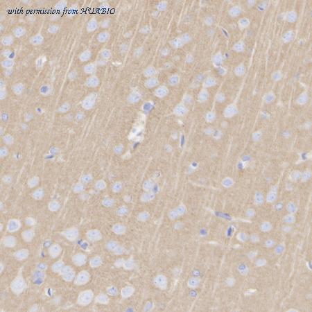 HUABIO HA610300 image 3