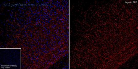 HUABIO HA610303 image 1