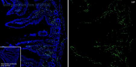 HUABIO HA610313 image 1