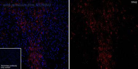 HUABIO HA610322 image 1