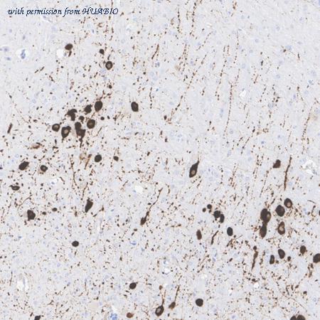 HUABIO HA610323 image 2