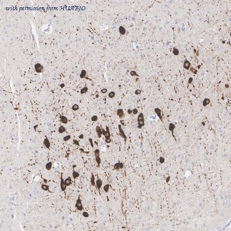 HUABIO HA610324 image 2