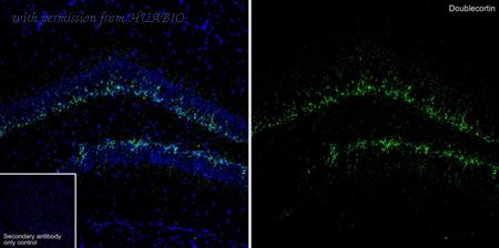 HUABIO HA610325 image 1