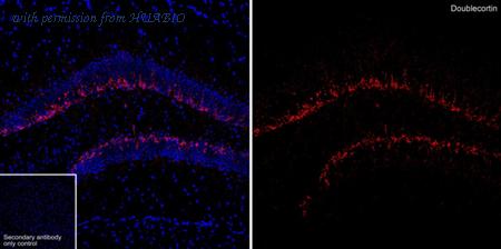 HUABIO HA610326 image 1