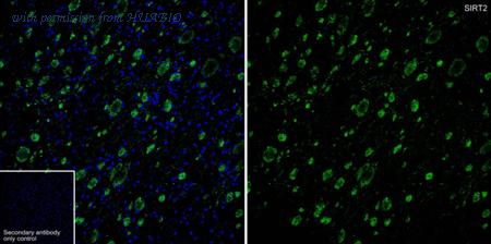 HUABIO HA610335 image 1