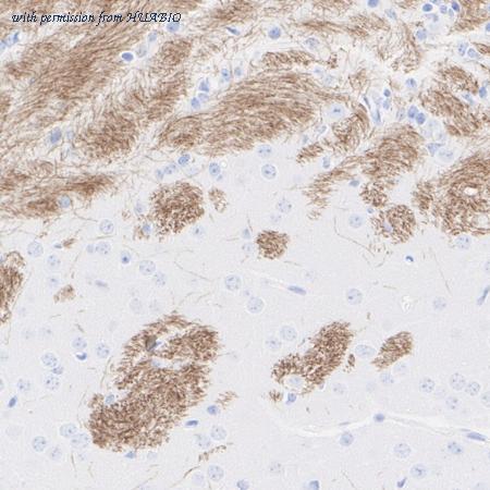 HUABIO HA610335 image 2