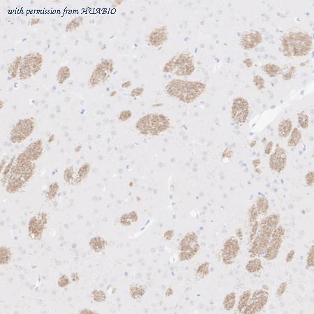 HUABIO HA610336 image 2