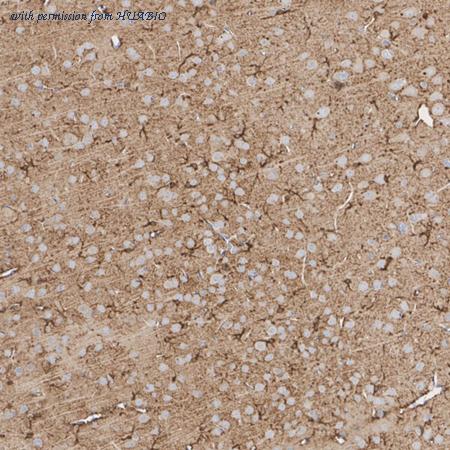 HUABIO HA610341 image 3