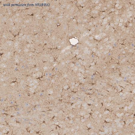 HUABIO HA610342 image 2