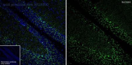 HUABIO HA751397 image 2