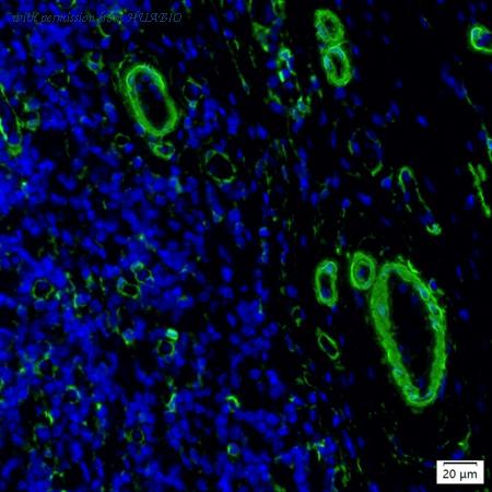 HUABIO IRS093MS image 1