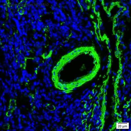 HUABIO IRS094RT image 1