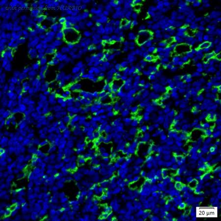 HUABIO IRS102MS image 1
