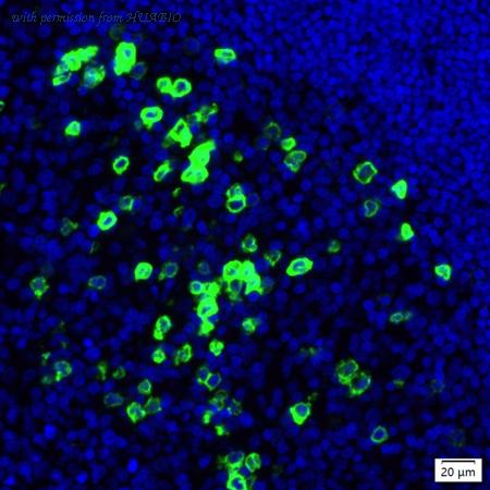 HUABIO IRS119RT image 1