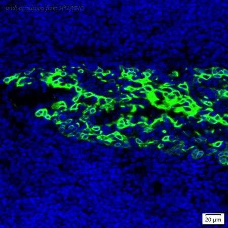 HUABIO IRS134RT image 1