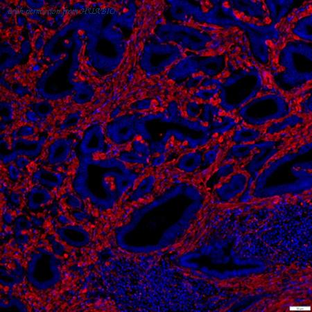 HUABIO IRS137RB image 1