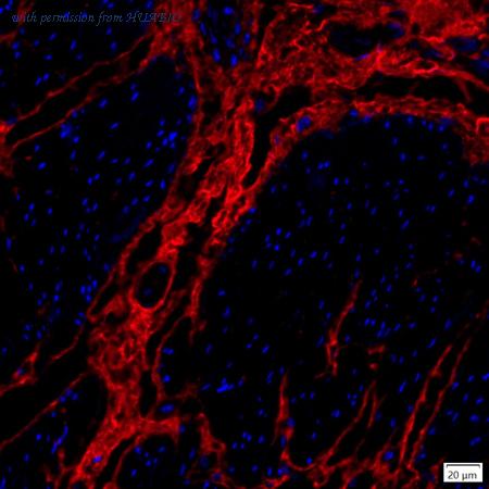 HUABIO IRS137RB image 2