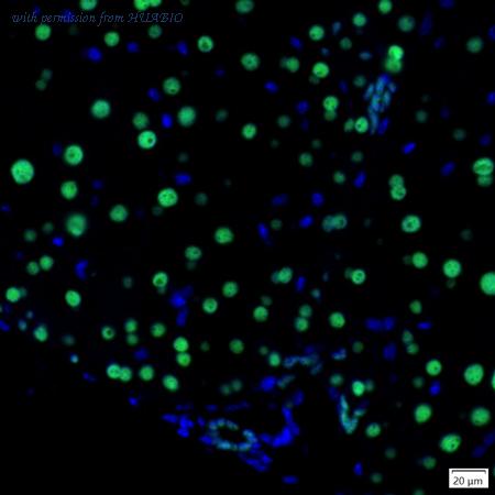 HUABIO IRS146RB image 1