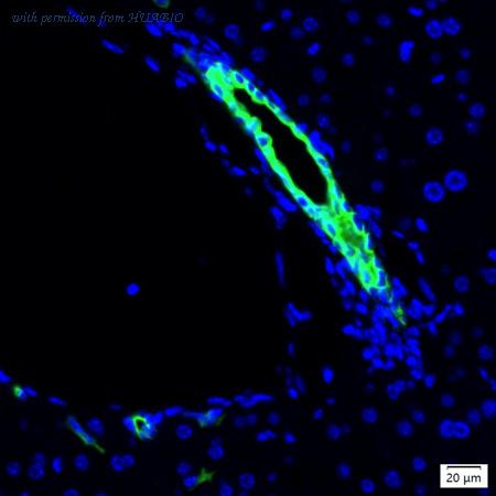 HUABIO IRS226RT image 1