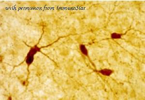 ImmunoStar 22940 image 1