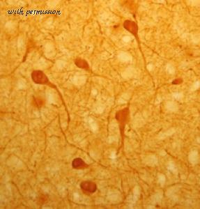 ImmunoStar 24427 image 1