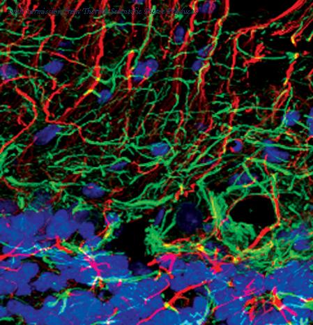 Invitrogen MA5-14981 image 1