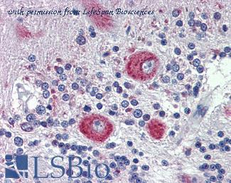 LifeSpan Biosciences LS-B3983 image 1