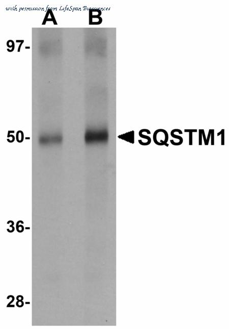 LifeSpan Biosciences LS-B4617 image 1